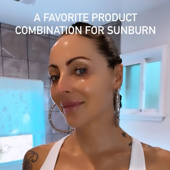 How to Heal Sunburn Fast
