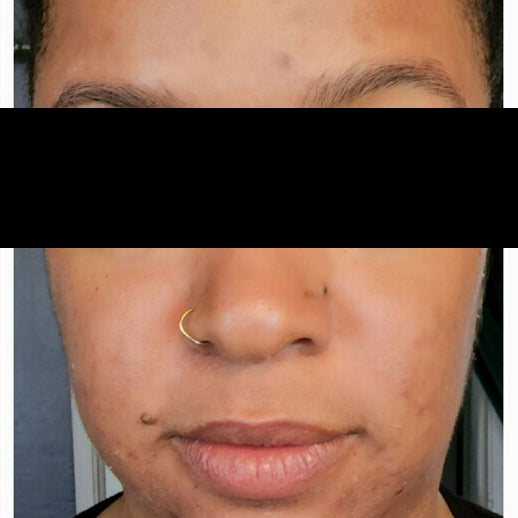 Lilac + Flint Before and After Photos | After Treatment Client 2