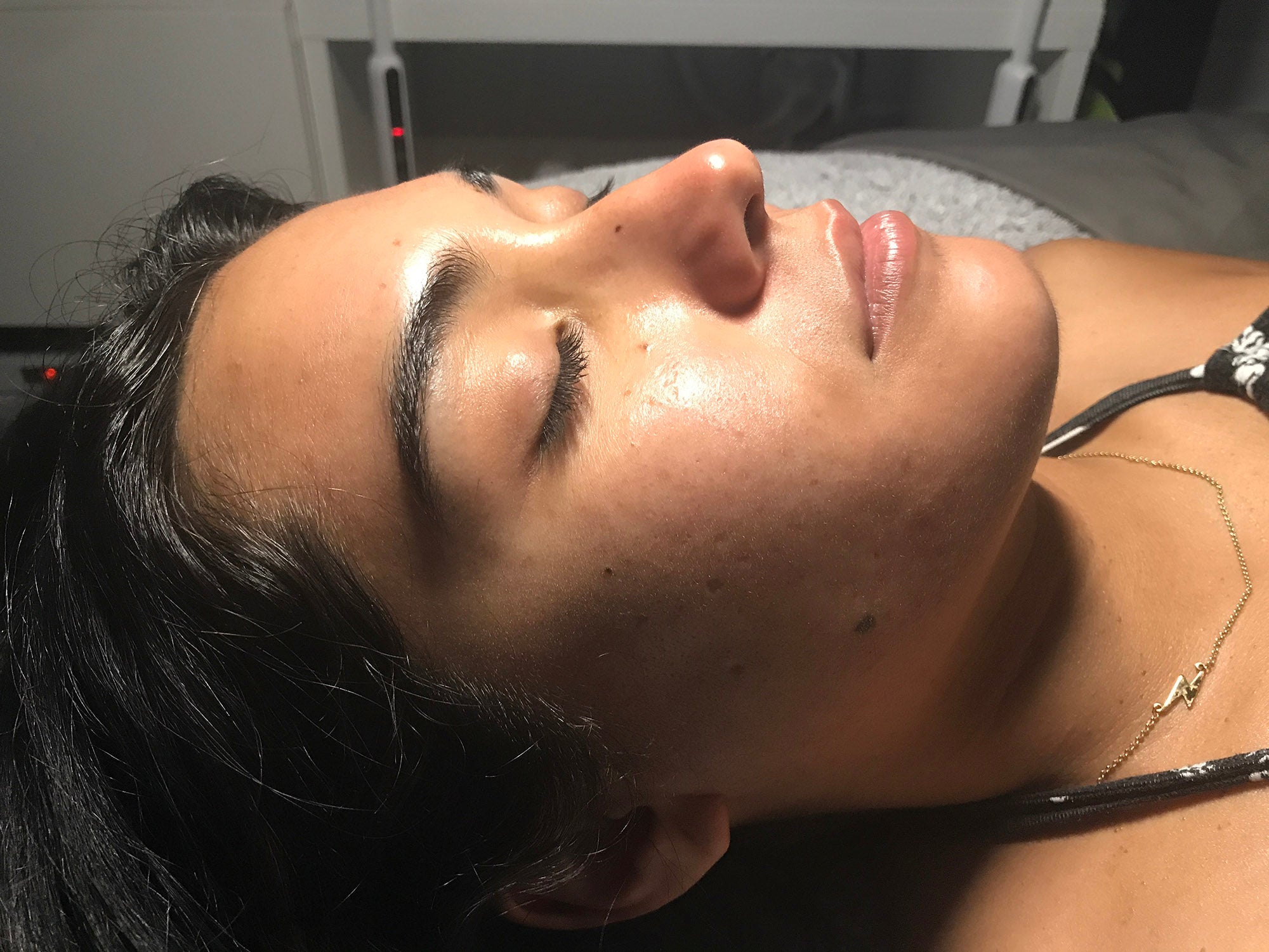 Lilac + Flint Before and After Photos | After Treatment Client 1